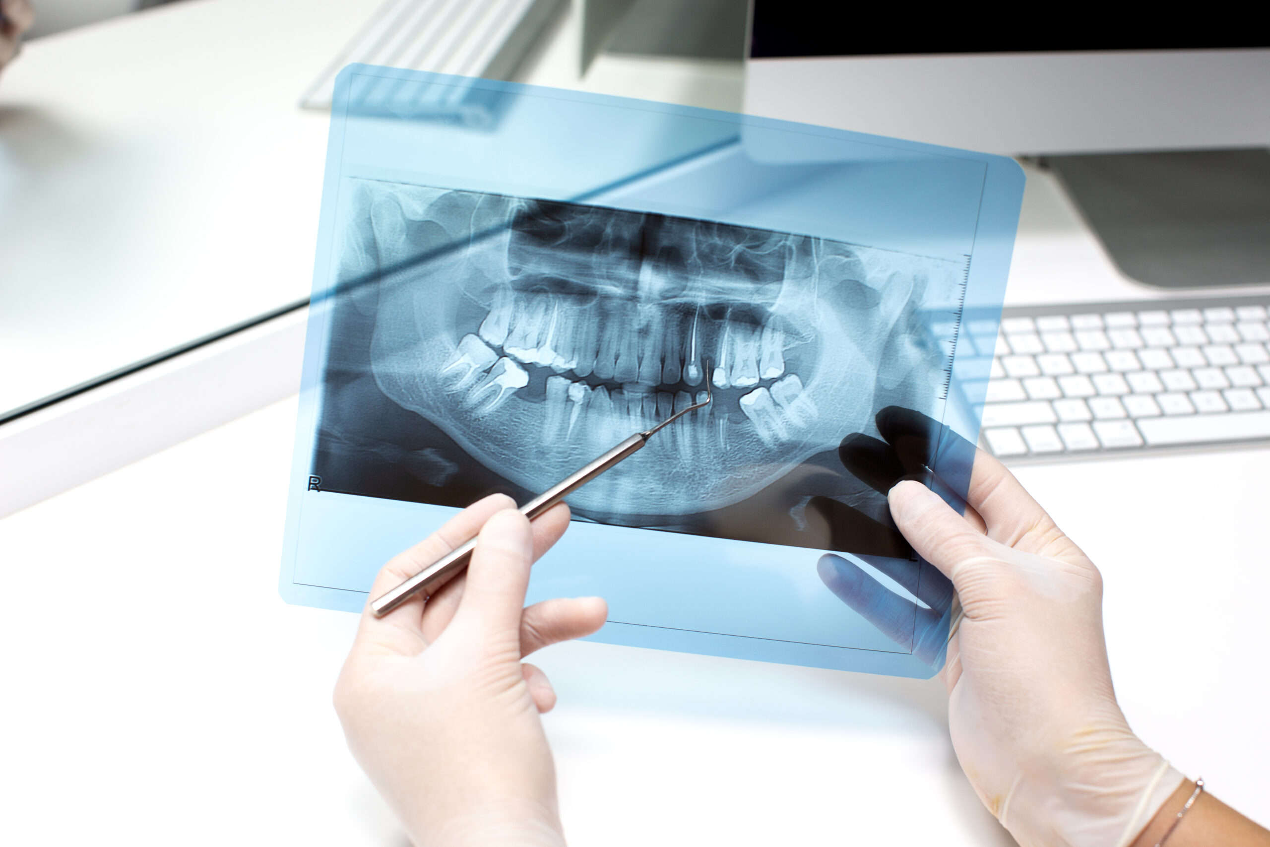 dentist analyzes x ray photo